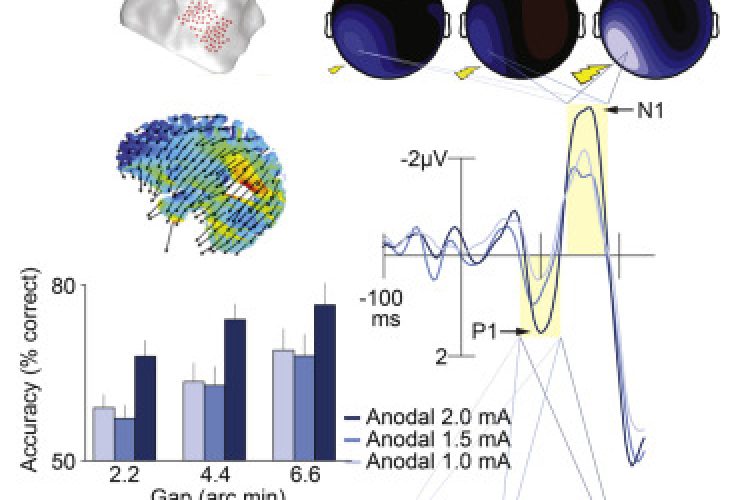 Electrical Currents can Improve your Vision